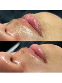 ヴィータ(VITA)/フェイスワックス