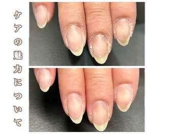 ケアの魅力について