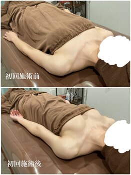 ロココ 大宮店(Rococo)/たった一回でこの変化