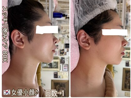 アルページュ(Arpege)の写真