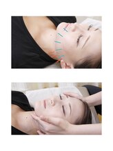 ネイビー鍼灸指圧治療院 那覇久米店(NAVY鍼灸指圧治療院)/美容鍼と小顔矯正でスッキリ