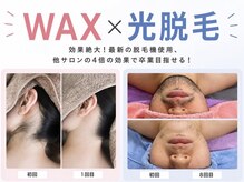 アルゴ 熊本光の森店(ALGO)の雰囲気（WAX併用で効果倍◎自己処理後のチクチクに～さよなら～）