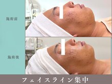 プレジール(plaisir)の雰囲気（一度のエステで変化を実感して下さい）