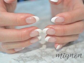 ミニョン 経堂(mignon)/フレンチ（ラメライン）