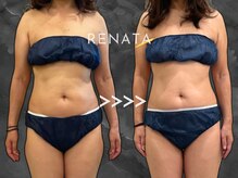 レナータ 新宿店(RENATA)/Before / After