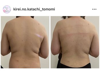 キレイノカタチ(Kirei No Katachi)/夏の薄着は後ろ姿が重要！？