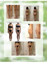 ミヨン(Miyong)/新メニュー!!痩身メニュー追加