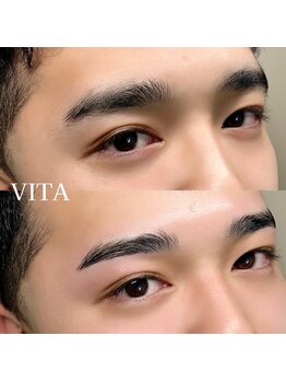 ヴィータ(VITA)/ハリウッドブロウリフト