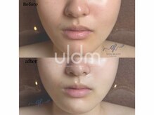 グレイスリリー 久屋 栄(grace lily)/NEW施術*uldm