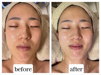 カレン アイビューティー(Karen Eyebeauty)/大人気ララピール!