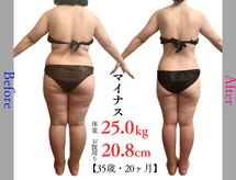 キレイ(KIREI)