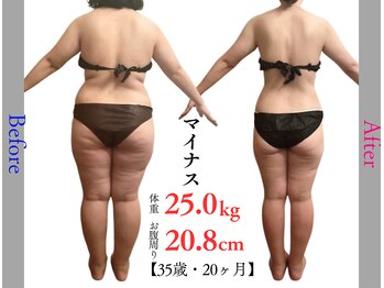 キレイ(KIREI)