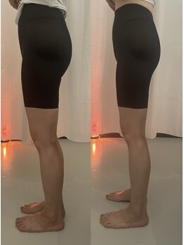 ラナン(Ranun)/きゅんきゅんヒップ