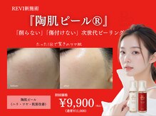 メアリー 西大寺(mary nail&eyelash)の雰囲気（REVI　陶肌ピール♪敏感肌でも本格肌ケア！毛穴・ハリツヤUP）