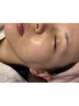 小顔になりたい