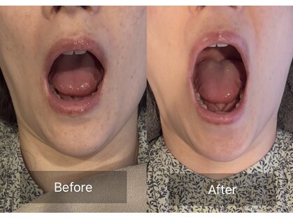 プライミー(PRIMY)の写真