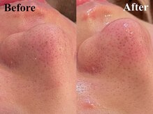 銀座ナチュラル スタイル (Natural Style)/人気メニュー◆毛穴洗浄