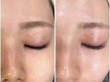 ティースリービューティー(T3Beauty)/圧倒的☆ツヤ肌に！ララピール