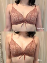 アンドボディ 横浜元町(&Body)/30代後半 &nbsp;バストアッ