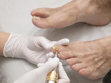 オーキッド巻き爪サロン