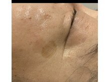 トゥーセブンネイルズ(TwoSevenNails)/くすみ、シミケア