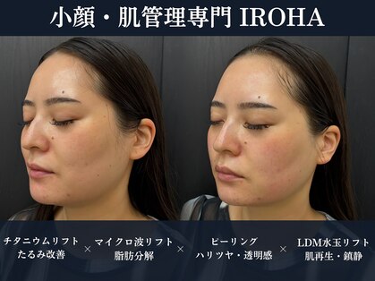 イロハ(IROHA)の写真