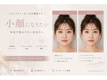 ビオール 池袋店(beall)の写真/顔の変化が目で見てわかる◎【小顔矯正60分6900円】眠ってしまうほど優しい施術で理想の小顔を実現&持続