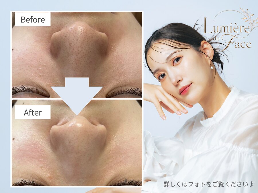 Lumiere de Face 品川の予約ページ掲載写真