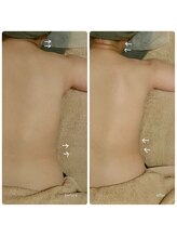 サロン ド サッコ(salon de sacco)/50代女性／肩首のこり・重だるさ