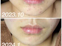 スウ(su:)/３ヶ月後には…☆