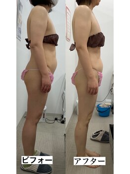 メリアミーゴ(Meli amigo)/50代 痩身ダイエット