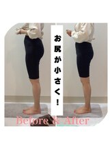 スタイルラボ高松/産後骨盤矯正の効果♪