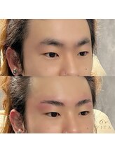 ヴィータ(VITA)/ハリウッドブロウリフト