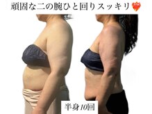 痩身革命 大宮店/ダイエットリンパマッサージ