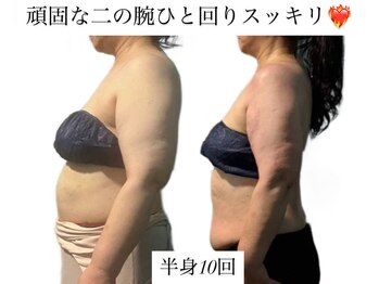 痩身革命 大宮店/ダイエットリンパマッサージ