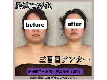 クチュール(couture.)/3回目after