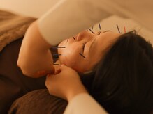 プライベート鍼灸サロン 十三 【肩こり/腰痛/マッサージ】
