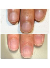 ミリアネイル 成城(Miliea nail)/