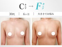 美人バスト 町田店の雰囲気(【育ちづらい原因を徹底解明】育乳のプロがバストアップを実現!)
