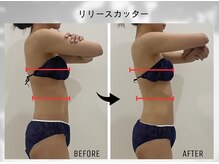セレンディピティー(Serendipity)の雰囲気（肩甲骨～腰のラインを筋膜リリースし、薄い印象のラインへ！）