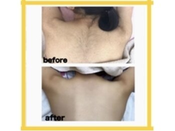 アルゴ 太田店(ALGO)/ コース開始前→コース１０回