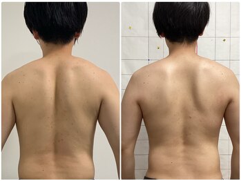 プリマプリート メンズ店/エンダモロジーインテグラル