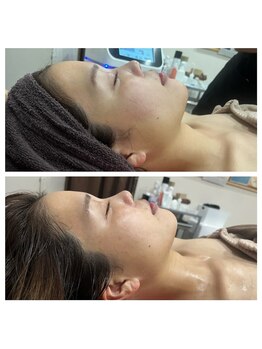 ココ 茅ヶ崎店(Coco)/小顔作り　お悩みに沿って