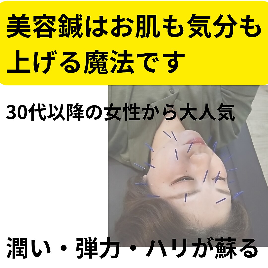 大人気！老け顔もカチコチ体も救済☆美容鍼×もみほぐしで女性の悩みに決別