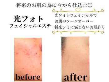 アルゴ 伊勢崎店(ALGO)/光フォト