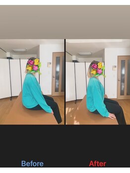 ヴィバランス(Vebalance)/猫背・骨盤矯正