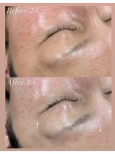 コーラル(CORAL)/30代*小顔リンパフェイシャル*