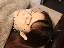 サボ 表参道 原宿(SABO)/頭皮までOK｜美容鍼×整体SABO