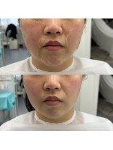 アジュ(aju)/超音波エステ