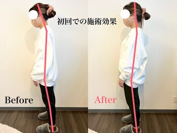 整体 寿 立川院(KOTOBUKI)/立川/整体/肩こり/腰痛/美容整体